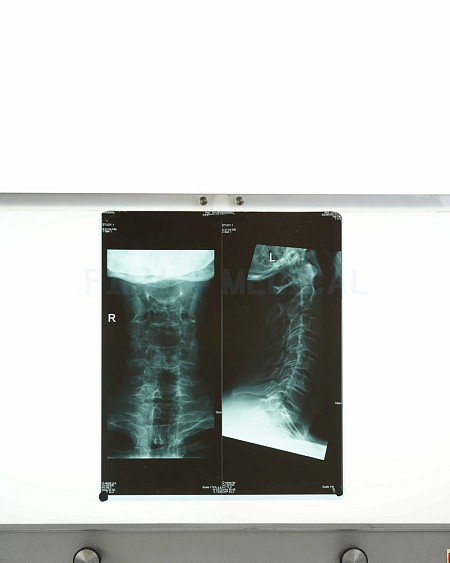 X_Ray Neck + Spine